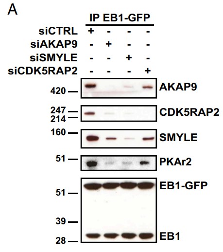 AKAP9 and SMYLE mediate CDK5RAP2 binding to EB1.jpg